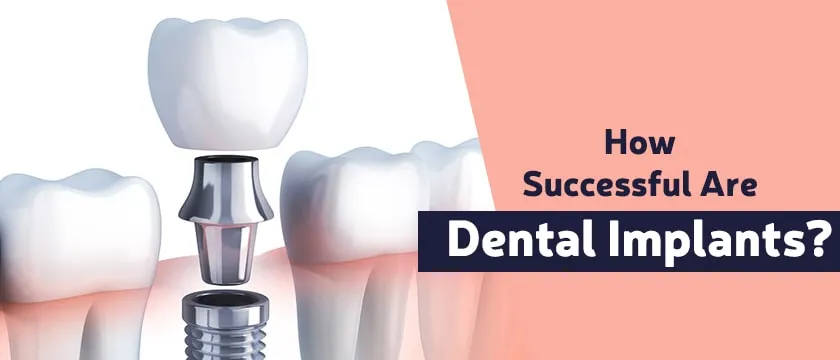 How successful are dental implants