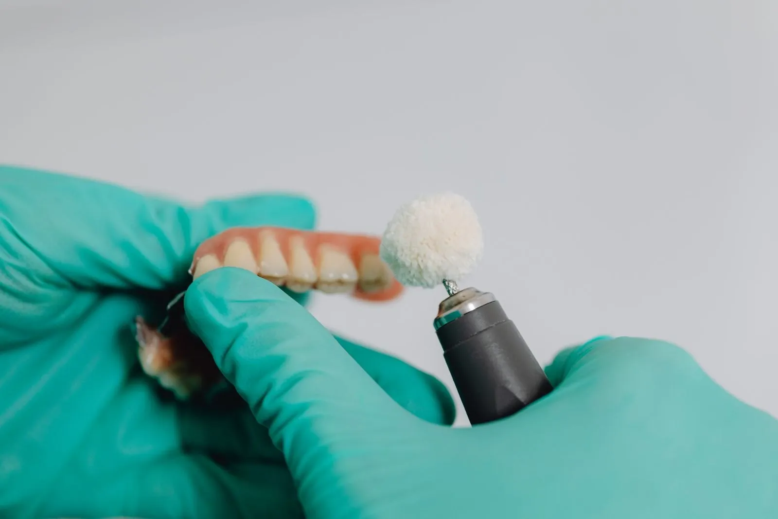 Dental Bridges & Crowns