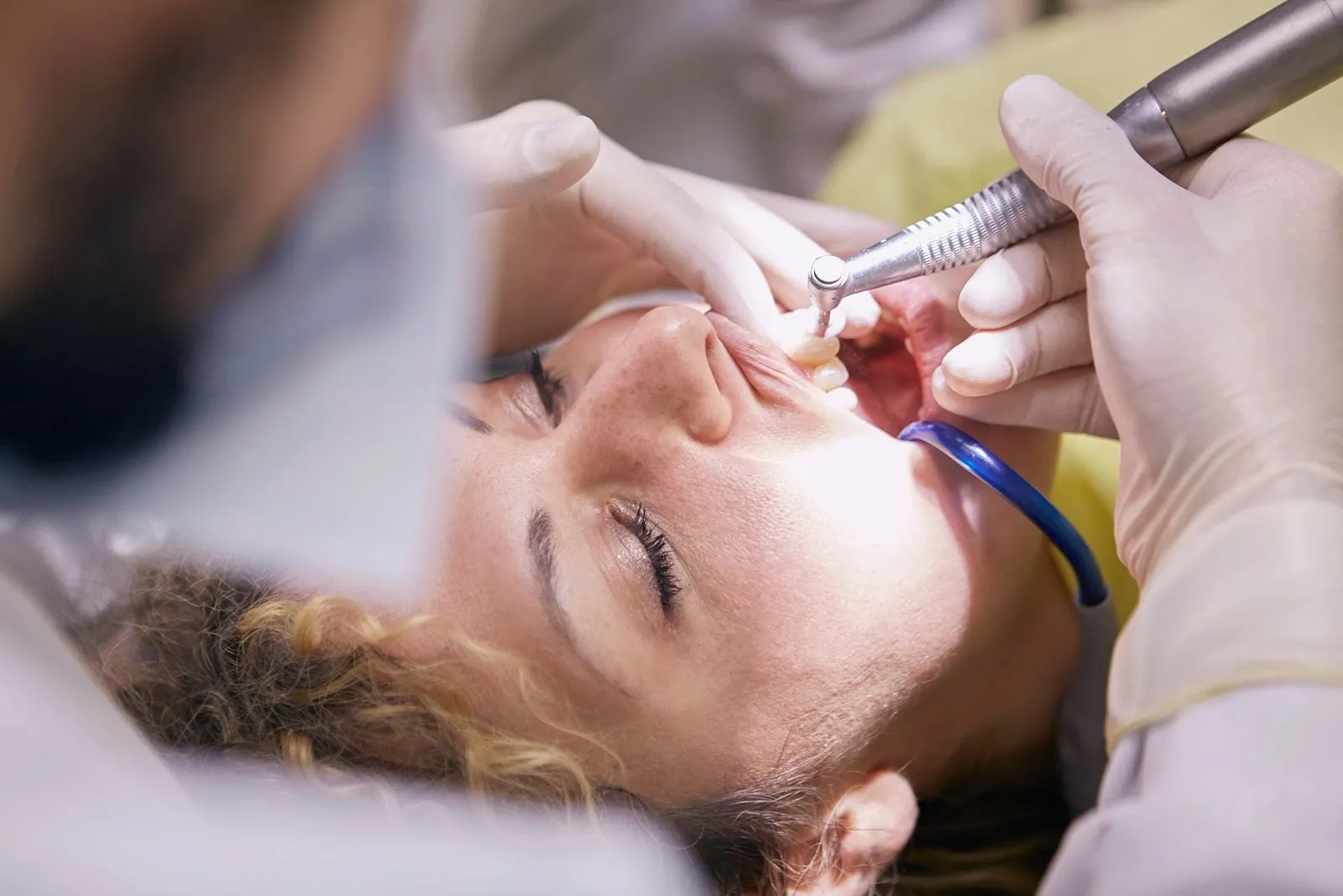 Root Canal Treatment