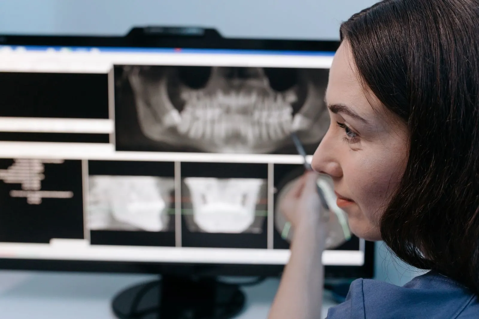Dental Imaging (OPG)