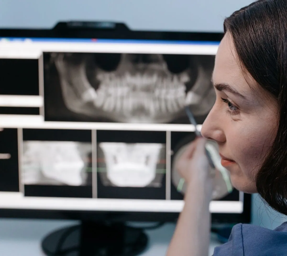 Know best about General Dentistry - Expert's Advice